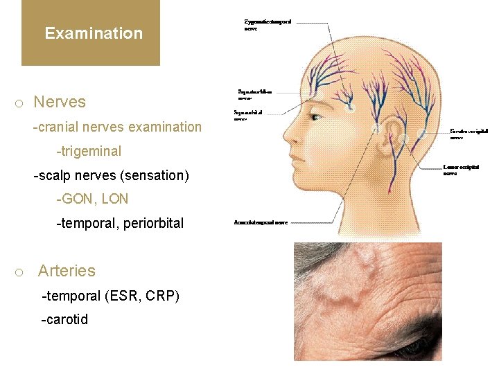 Examination o Nerves -cranial nerves examination -trigeminal -scalp nerves (sensation) -GON, LON -temporal, periorbital