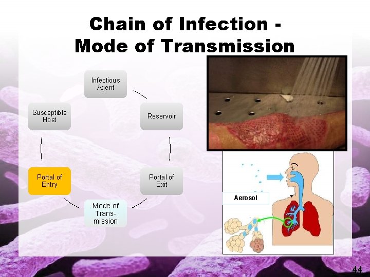 Chain of Infection Mode of Transmission Infectious Agent Susceptible Host Reservoir Portal of Entry
