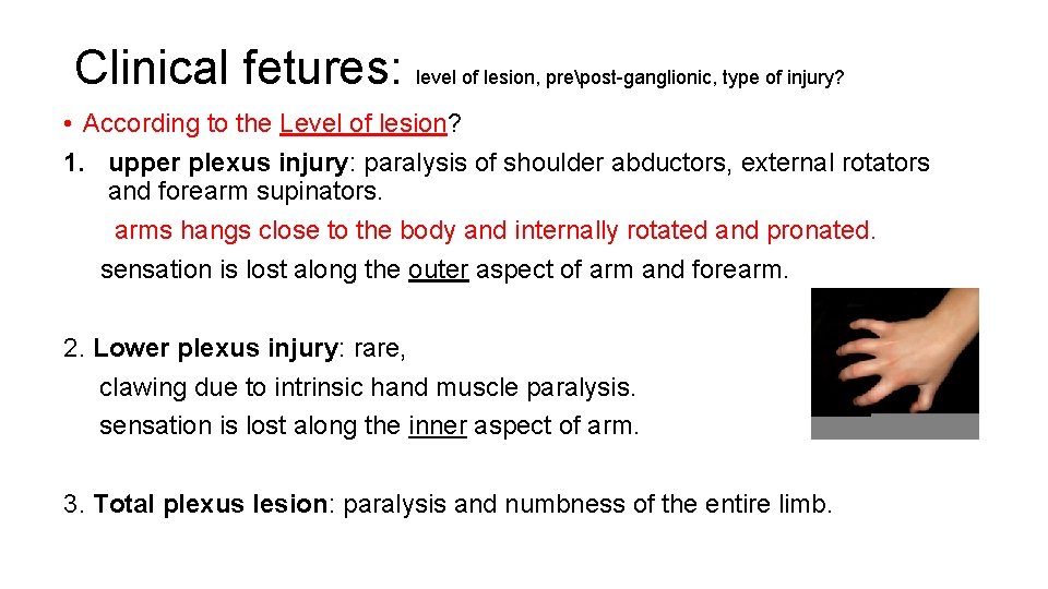 Clinical fetures: level of lesion, prepost-ganglionic, type of injury? • According to the Level