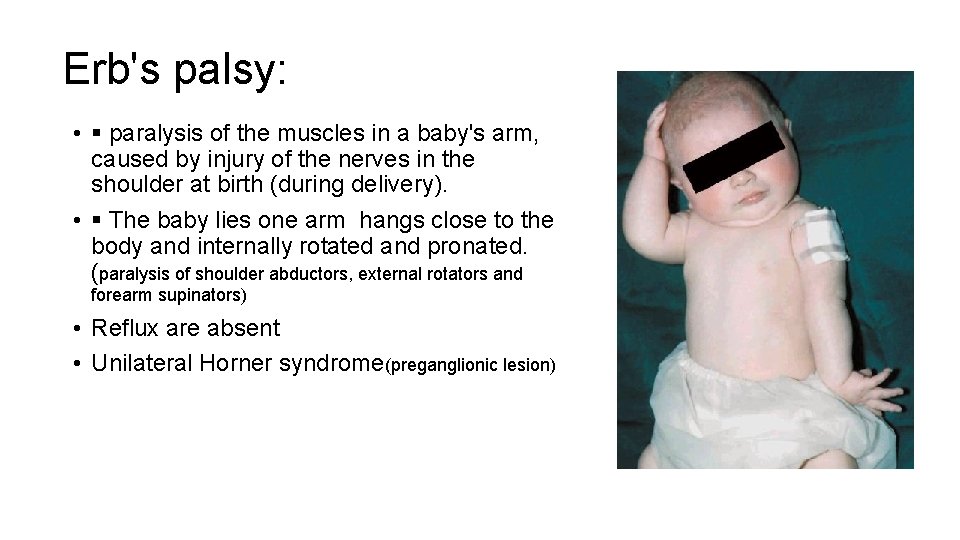 Erb's palsy: • paralysis of the muscles in a baby's arm, caused by injury