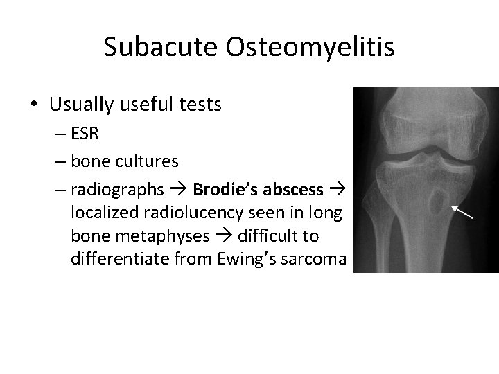 Subacute Osteomyelitis • Usually useful tests – ESR – bone cultures – radiographs Brodie’s