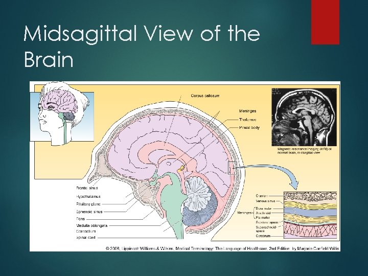 Midsagittal View of the Brain 