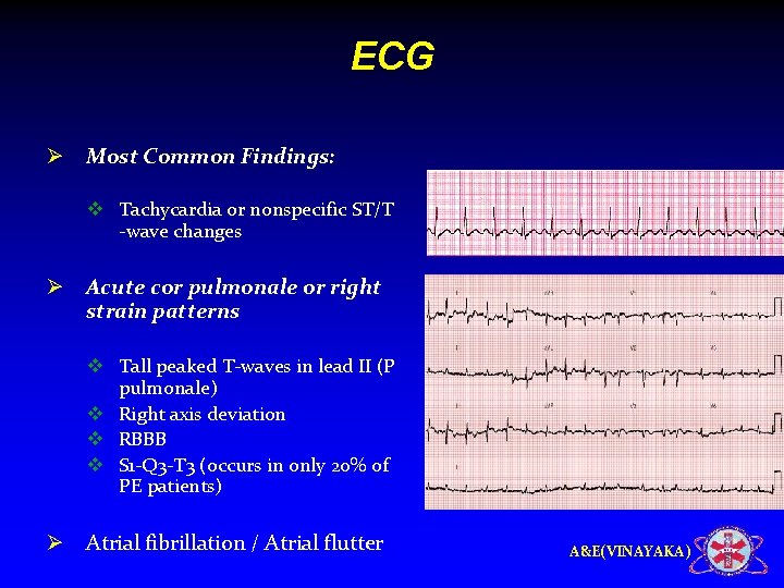 ECG Ø Most Common Findings: v Tachycardia or nonspecific ST/T -wave changes Ø Acute