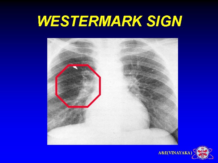 WESTERMARK SIGN A&E(VINAYAKA) 