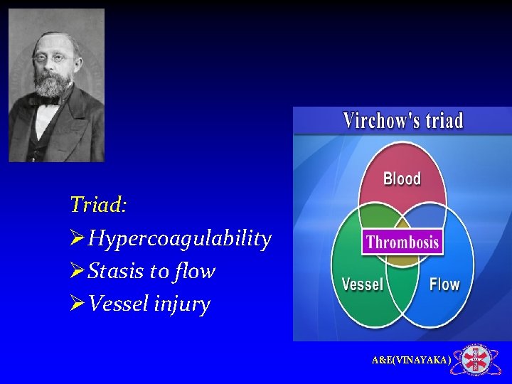 Triad: ØHypercoagulability ØStasis to flow ØVessel injury A&E(VINAYAKA) 