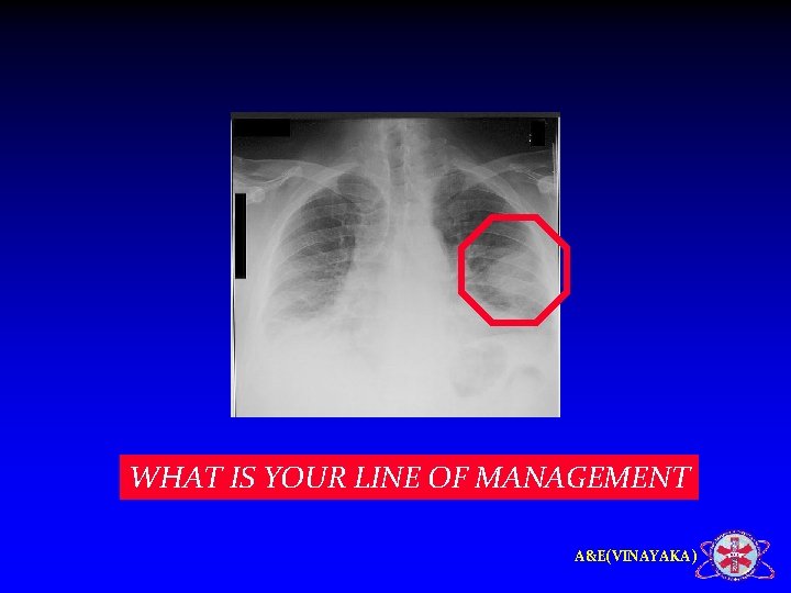 WHAT IS YOUR LINE OF MANAGEMENT A&E(VINAYAKA) 