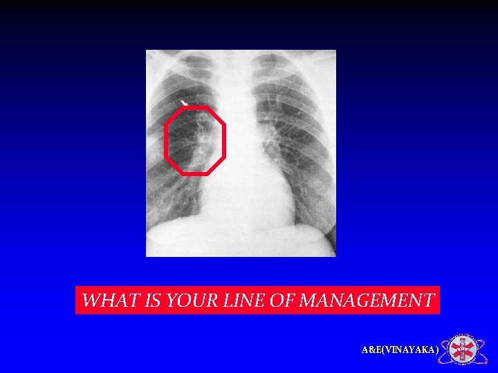 WHAT IS YOUR LINE OF MANAGEMENT A&E(VINAYAKA) 