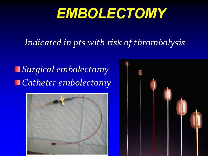 EMBOLECTOMY Indicated in pts with risk of thrombolysis Surgical embolectomy Catheter embolectomy A&E(VINAYAKA) 