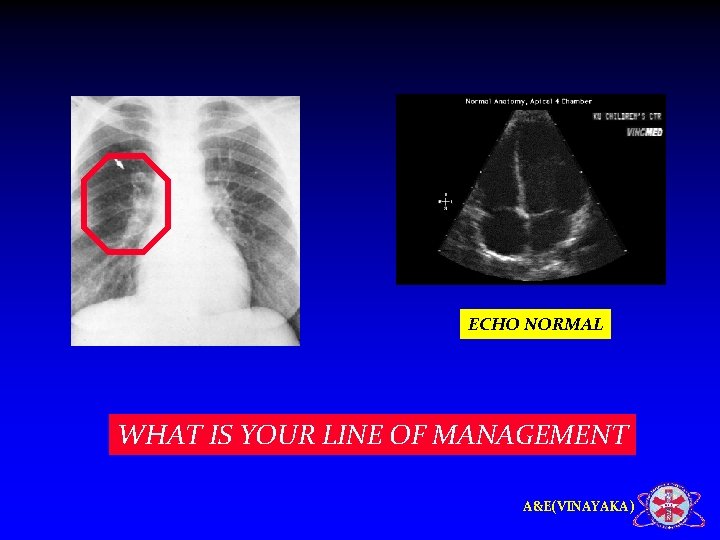 ECHO NORMAL WHAT IS YOUR LINE OF MANAGEMENT A&E(VINAYAKA) 