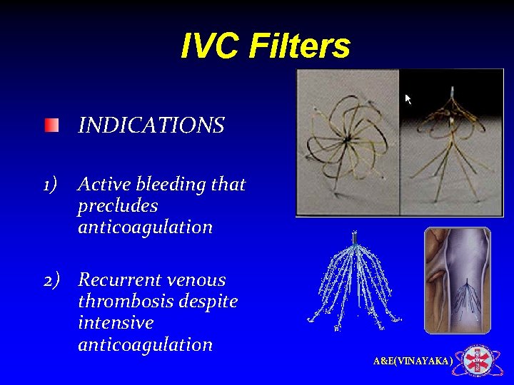 IVC Filters INDICATIONS 1) Active bleeding that precludes anticoagulation 2) Recurrent venous thrombosis despite