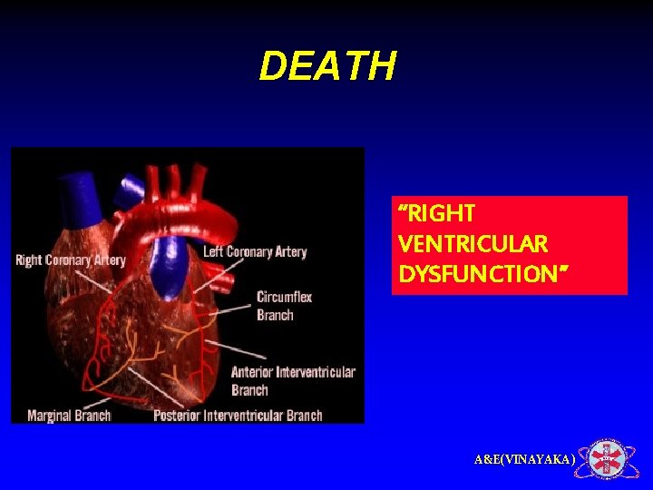 DEATH “RIGHT VENTRICULAR DYSFUNCTION” A&E(VINAYAKA) 