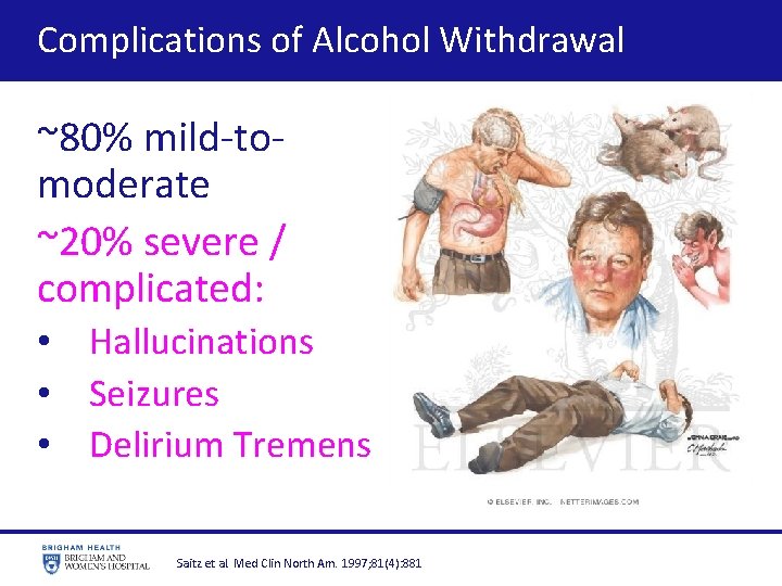  Complications of Alcohol Withdrawal ~80% mild-tomoderate ~20% severe / complicated: • Hallucinations •