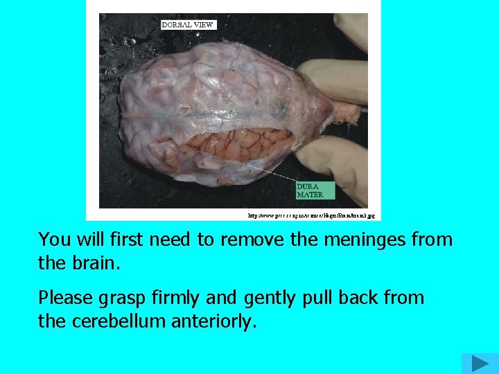 http: //www. pccc. nj. us/science/Hager/Brain/brain 3. jpg You will first need to remove the