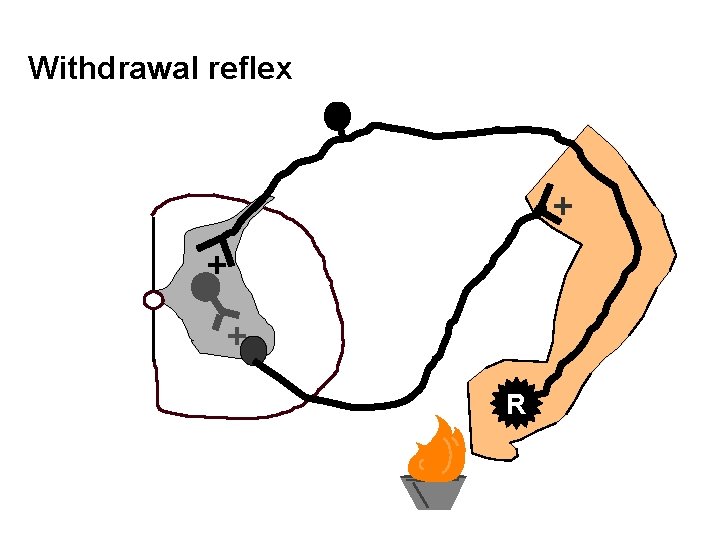 Withdrawal reflex + + + R 