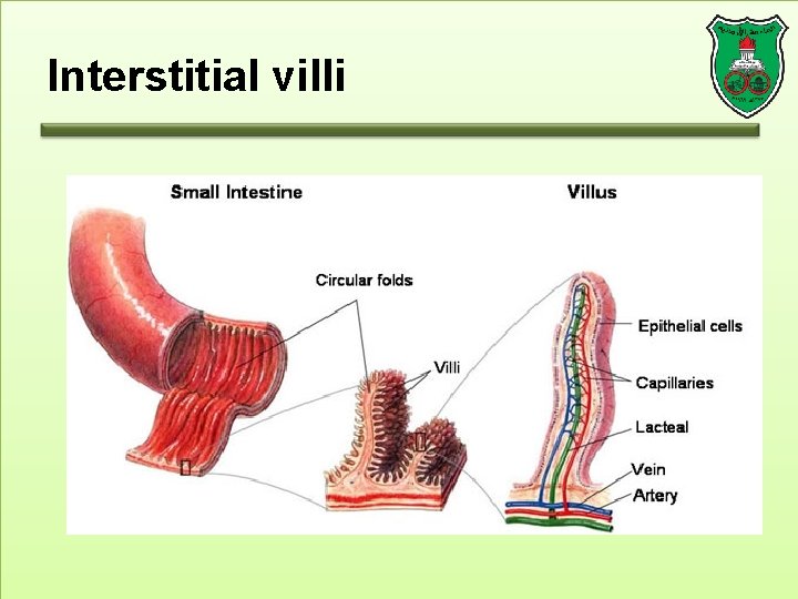 Interstitial villi 