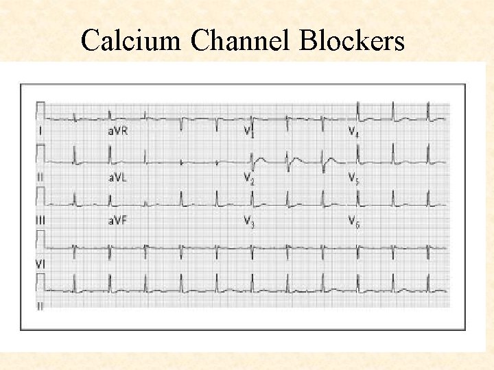 Calcium Channel Blockers 