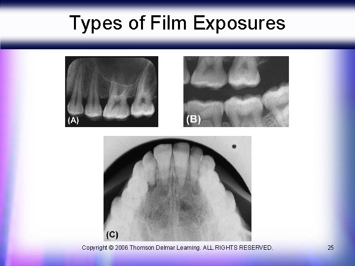 Types of Film Exposures Copyright © 2006 Thomson Delmar Learning. ALL RIGHTS RESERVED. 25
