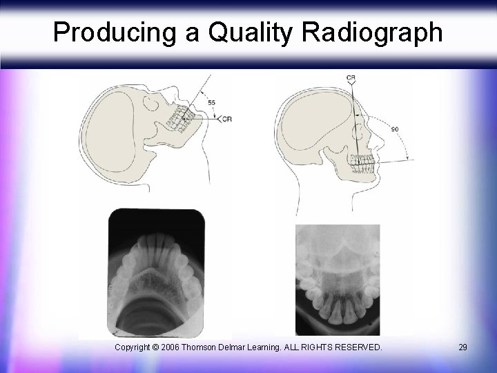 Producing a Quality Radiograph Copyright © 2006 Thomson Delmar Learning. ALL RIGHTS RESERVED. 29