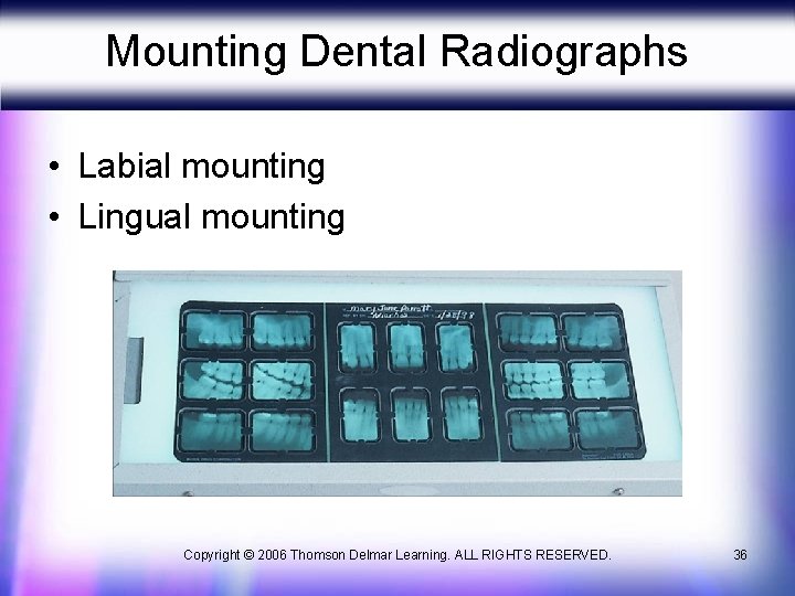 Mounting Dental Radiographs • Labial mounting • Lingual mounting Copyright © 2006 Thomson Delmar