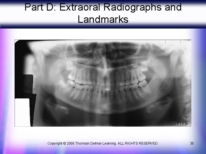 Part D: Extraoral Radiographs and Landmarks Copyright © 2006 Thomson Delmar Learning. ALL RIGHTS