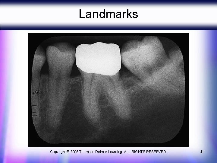 Landmarks Copyright © 2006 Thomson Delmar Learning. ALL RIGHTS RESERVED. 41 