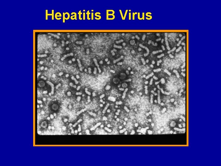 Hepatitis B Virus 