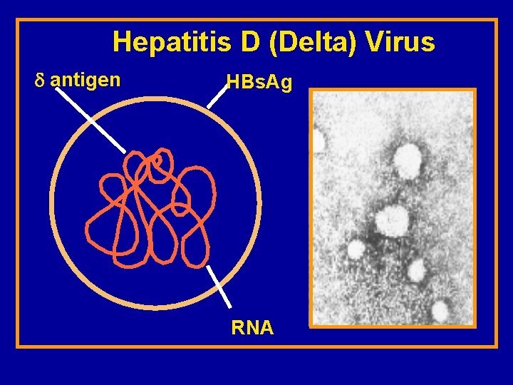 Hepatitis D (Delta) Virus antigen HBs. Ag RNA 