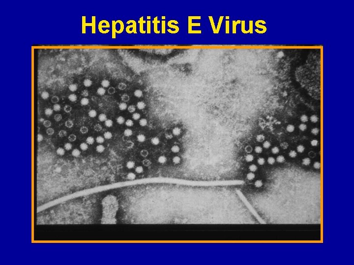 Hepatitis E Virus 