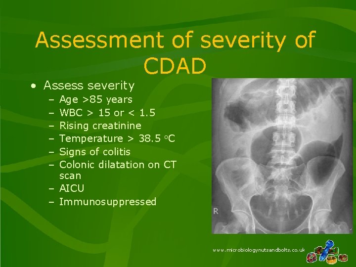 Assessment of severity of CDAD • Assess severity – – – Age >85 years Assessment of severity of CDAD • Assess severity – – – Age >85 years