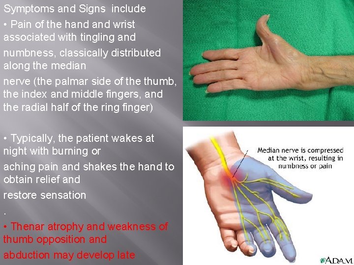 Symptoms and Signs include • Pain of the hand wrist associated with tingling and