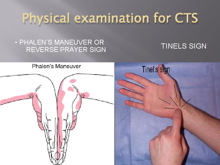 Physical examination for CTS • PHALEN’S MANEUVER OR REVERSE PRAYER SIGN TINELS SIGN 