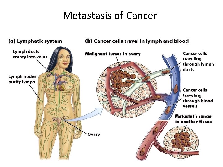 Metastasis of Cancer 