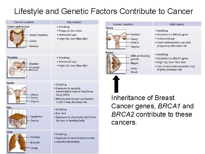 Lifestyle and Genetic Factors Contribute to Cancer Inheritance of Breast Cancer genes, BRCA 1