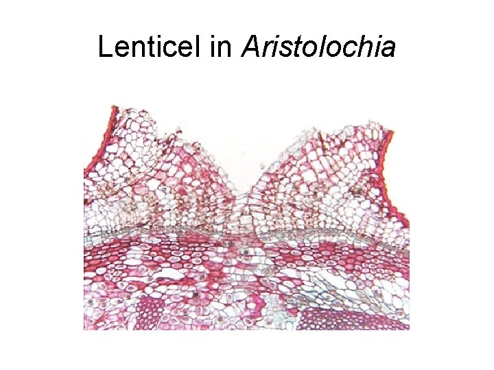 Lenticel in Aristolochia 