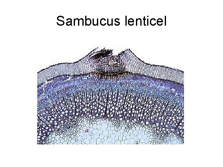 Sambucus lenticel 