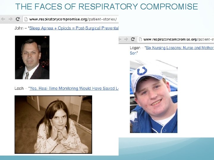 THE FACES OF RESPIRATORY COMPROMISE 