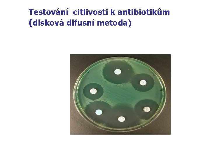 Testování citlivosti k antibiotikům (disková difusní metoda) 