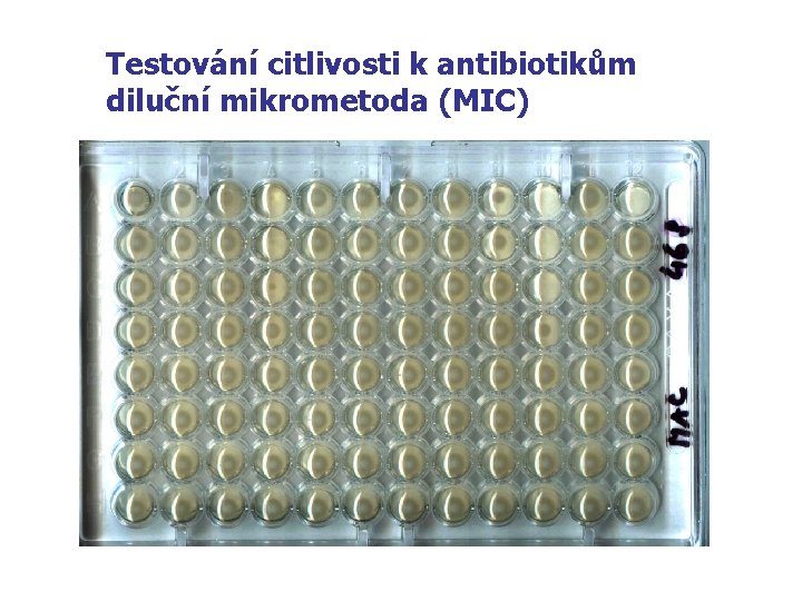 Testování citlivosti k antibiotikům diluční mikrometoda (MIC) 