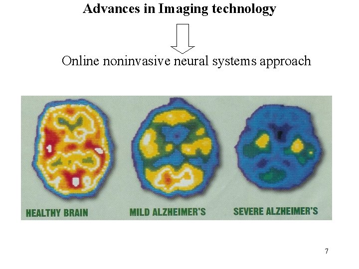 Advances in Imaging technology Online noninvasive neural systems approach 7 