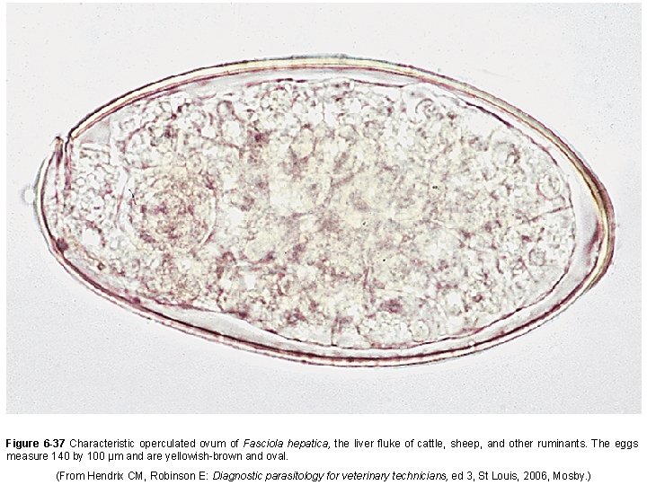 Figure 6 -37 Characteristic operculated ovum of Fasciola hepatica, the liver fluke of cattle,