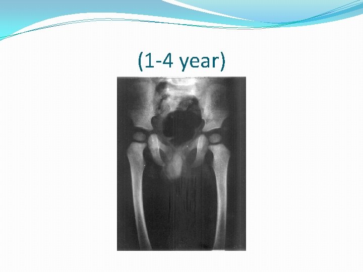 (1 -4 year) 