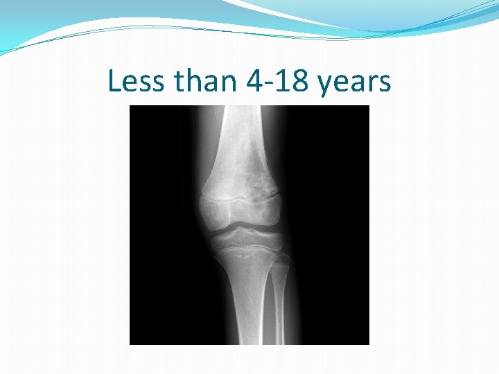 Less than 4 -18 years 