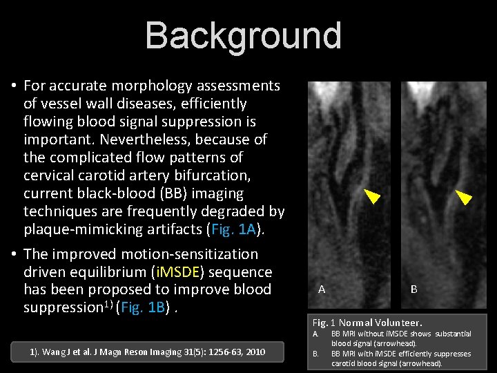 Background • For accurate morphology assessments of vessel wall diseases, efficiently flowing blood signal