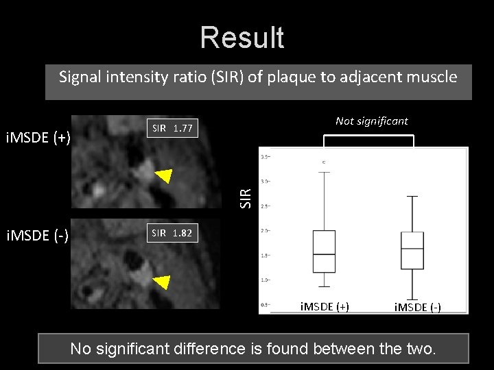 Result Signal intensity ratio (SIR) of plaque to adjacent muscle SIR i. MSDE (+)