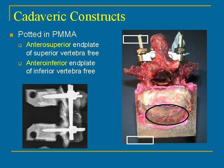 Cadaveric Constructs n Potted in PMMA q q Anterosuperior endplate of superior vertebra free