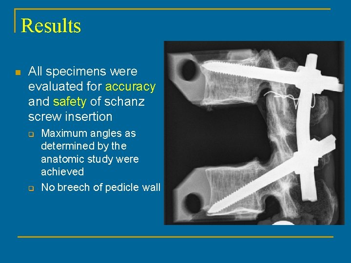 Results n All specimens were evaluated for accuracy and safety of schanz screw insertion