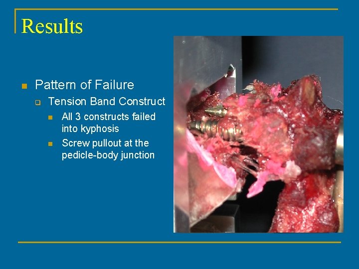 Results n Pattern of Failure q Tension Band Construct n n All 3 constructs