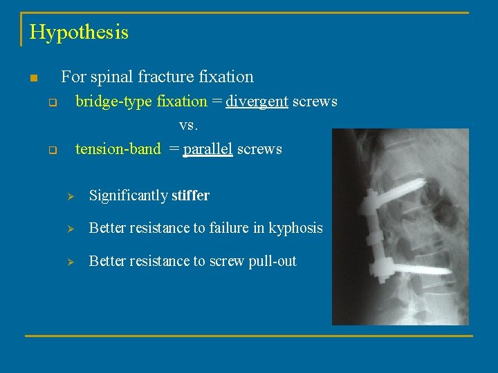 Hypothesis For spinal fracture fixation n bridge-type fixation = divergent screws vs. tension-band =