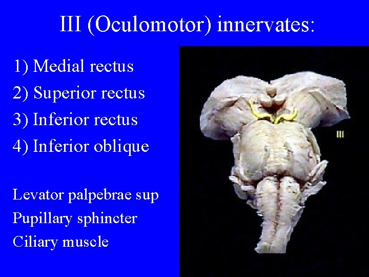 III (Oculomotor) innervates: 1) Medial rectus 2) Superior rectus 3) Inferior rectus 4) Inferior