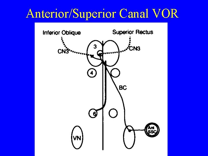 Anterior/Superior Canal VOR 